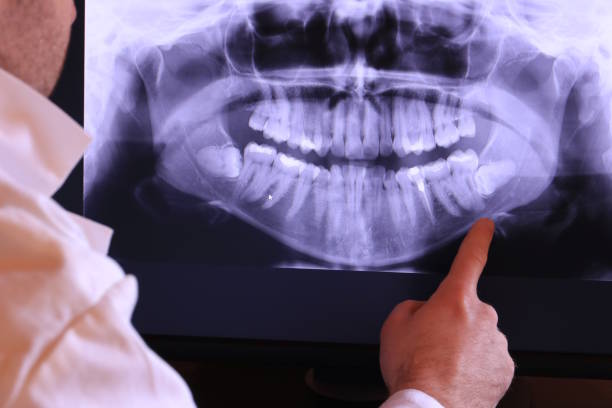 Best Emergency Dentist for Special Needs Patients in Angola, IN